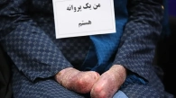 بیماری پروانه ای چیست